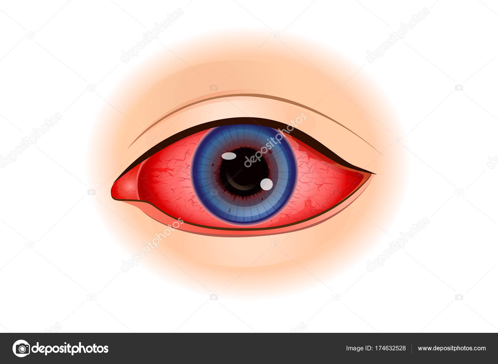 Image html